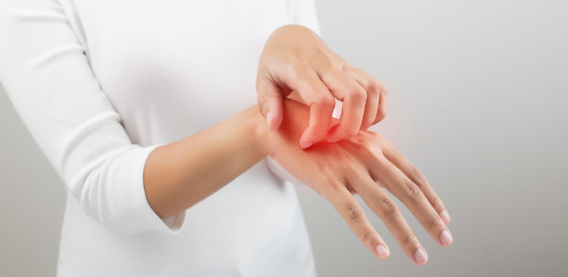 Tévhitek a hisztaminintoleranciáról